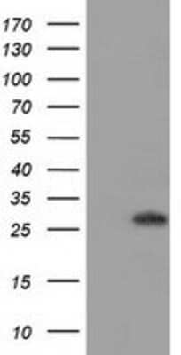 Western Blot: BIN3 Antibody (8E9) [NBP2-03389] - HEK293T cells were transfected with the pCMV6-ENTRY control (Left lane) or pCMV6-ENTRY BIN3 (Right lane) cDNA for 48 hrs and lysed. Equivalent amounts of cell lysates (5 ug per lane) were separated by SDS-PAGE and immunoblotted with anti-BIN3.