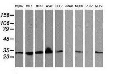 Western Blot: BIN3 Antibody (OTI8E9) - Azide and BSA Free [NBP2-72051] - Analysis of extracts (35ug) from 9 different cell lines by using anti-BIN3 monoclonal antibody.