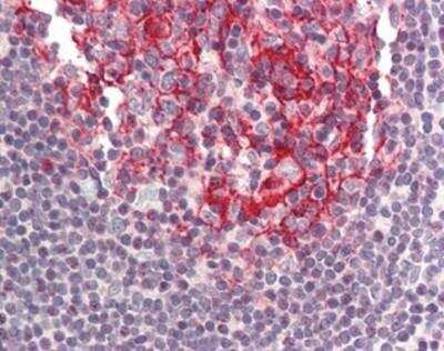 Immunohistochemistry-Paraffin: BIRC8 Antibody [NBP1-03071] - Staining of human small intestine, Peyer's patch. Immunohistochemistry of formalin-fixed, paraffin-embedded tissue after heat-induced antigen retrieval. Antibody concentration 5 ug/ml.