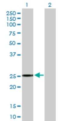 Western Blot: BIRC8 Antibody [H00112401-B01P] - Analysis of BIRC8 expression in transfected 293T cell line by BIRC8 polyclonal antibody.  Lane 1: BIRC8 transfected lysate(25.96 KDa). Lane 2: Non-transfected lysate.