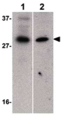 Western Blot: BIRC8 Antibody [NBP1-03071] - Western blot of BIRC8 expression in human HepG2 (lane 1) and MOLT4 (lane 2) cell lysates with BIRC8 antibody at 1 ug/ml.