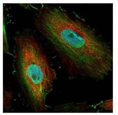 Immunocytochemistry/ Immunofluorescence BIVM Antibody