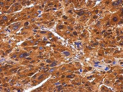 Immunohistochemistry-Paraffin BIVM Antibody