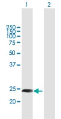 Western Blot BJHCC20A Antibody - Azide and BSA Free