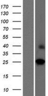 Western Blot: BJHCC20A Overexpression Lysate (Native) [NBP2-06906] - BJHCC20A Overexpression Lysate (Native) Left-Empty vector transfected control cell lysate (HEK293 cell lysate); Right -Over-expression Lysate for CXorf48.