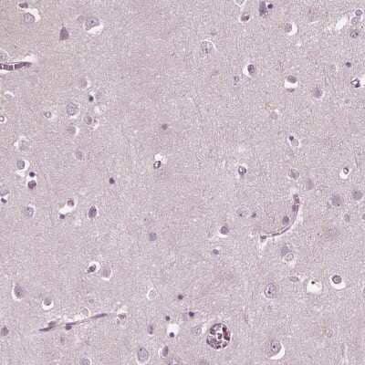 <b>Orthogonal Strategies Validation. </b>Immunohistochemistry-Paraffin: BLAME/SLAMF8 Antibody [NBP2-56595] - Staining of human cerebral cortex shows low expression as expected.