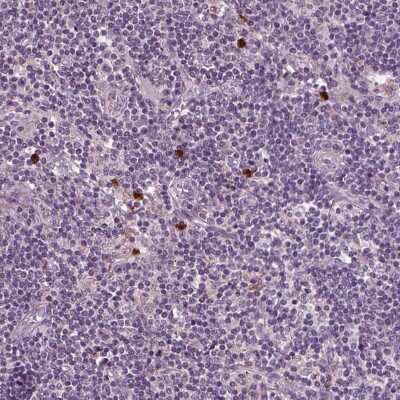 Immunohistochemistry-Paraffin: BLAME/SLAMF8 Antibody [NBP2-56595] - Staining of human lymph node shows high expression.