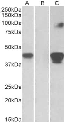 Western Blot: BLAME/SLAMF8 Antibody [NBP2-26110] - HEK293 lysate (10 ug protein in RIPA buffer) overexpressing Human SLAMF8 with C-terminal MYC tag probed with NBP2-26110 (1 ug/ml) in Lane A and probed with anti-MYC Tag (1/1000) in lane C. Mock-transfected HEK293 probed with NBP2-26110 (1 ug/ml) in Lane B. Primary incubations were for 1 hour. Detected by chemiluminescence.