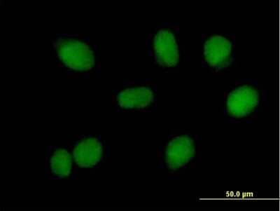 Immunocytochemistry/Immunofluorescence: BLAP75 Antibody [H00080010-B02P] - Analysis of purified antibody to RMI1 on HeLa cell. (antibody concentration 10 ug/ml)