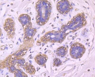 Immunohistochemistry-Paraffin: BLCAP Antibody (4E1) [NBP2-75420] - Analysis of paraffin-embedded human breast tissue using anti-BLCAP antibody. Counter stained with hematoxylin.