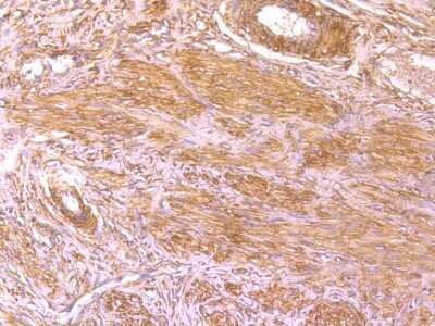 Immunohistochemistry-Paraffin: BLCAP Antibody (4E1) [NBP2-75420] - Analysis of paraffin-embedded rat cervix tissue using anti-BLCAP antibody. Counter stained with hematoxylin.