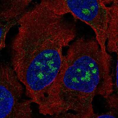 Immunocytochemistry/ Immunofluorescence BLCAP Antibody