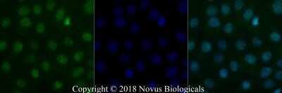 Immunocytochemistry/Immunofluorescence: BLIMP1/PRDM1 Antibody (3H2-E8) - Azide and BSA Free [NBP2-80597] - A431 cells were fixed for 10 minutes using 10% formalin and then permeabilized for 5 minutes using 1X PBS + 0.5% Triton-X100. The cells were incubated with anti-BLIMP1 (3H2-E8) at 10 ug/ml overnight at 4C and detected with an anti-mouse IgG Dylight 488 (Green) at a 1:500 dilution. Nuclei were counterstained with DAPI (Blue). Cells were imaged using a 40X objective. Image from the standard format of this antibody.