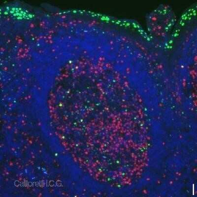 Immunocytochemistry/Immunofluorescence: BLIMP1/PRDM1 Antibody (3H2-E8) - Azide and BSA Free [NBP2-80597] - Double IF for Blimp-1 (green) and Ki-67 (proliferation, red) with DAPI counterstain, at 10x magnification (scale bar is 10um). Positive surface epithelium and centrocytes are labelled. Photo courtesy of Dr. Giorgio Cattoretti, Institute for Cancer Genetics, Columbia University, NY. Image from the standard format of this antibody.