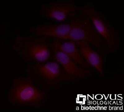 Immunocytochemistry/Immunofluorescence: BLIMP1/PRDM1 Antibody (3H2-E8) - Azide and BSA Free [NBP2-80597] - HeLa cells were fixed for 10 minutes using 10% formalin and then permeabilized for 5 minutes using 1X PBS + 0.05% Triton-X100. The cells were incubated with anti-BLIMP1/PRDM1 (3H2-E8) conjugated to DyLight 550 [NB600-235R] at 20ug/ml for 1 hour at room temperature. Nuclei were counterstained with DAPI (Blue). Cells were imaged using a 40X objective. Image from the standard format of this antibody.