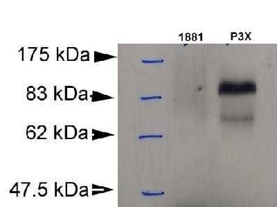 Western Blot: BLIMP1/PRDM1 Antibody (3H2-E8) - Azide and BSA Free [NBP2-80597] - Detection of Blimp-1 in murine plasmacytoma cell lysate (P3X) using NB 600-235. 1881: murine pre-B cell lysate (negative control). Photo courtesy of DA Savitsky, Columbia University. Image from the standard format of this antibody.