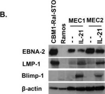 Western Blot: BLIMP1/PRDM1 Antibody (3H2-E8) - Azide and BSA Free [NBP2-80597] - The effect of IL-21 and CD40L exposure on MEC1 and MEC2 cells. Expression of EBNA-2 and LMP-1 in IL-21 treated cells. Expression of EBNA-2, LMP-1 and Blimp-1 by immunoblotting; positive control: CBM1-Ral-STO, negative control: Ramos. 1.5x105 cells were loaded in the control lanes and 5x105 were loaded in both untreated and IL-21 treated MEC1 and MEC2 lanes. Note low expression of EBNA-2 and high expression of LMP-1 after IL-21 treatment and induction of Blimp-1 after IL-21 treatment. Image collected and cropped by CiteAb from the following publication (//dx.plos.org/10.1371/journal.pone.0106008), licensed under a CC-BY license. Image from the standard format of this antibody.