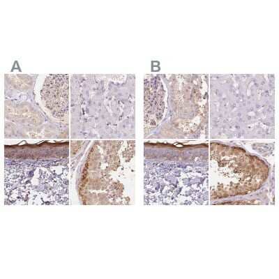 <b>Independent Antibodies Validation. </b>Immunohistochemistry-Paraffin: BLMH/Bleomycin Hydrolase Antibody [NBP1-88640] - Staining of human kidney, liver, skin and testis using Anti-BLMH antibody NBP1-88640 (A) shows similar protein distribution across tissues to independent antibody NBP2-39023 (B).