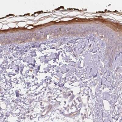 Immunohistochemistry-Paraffin: BLMH/Bleomycin Hydrolase Antibody [NBP2-39023] - Staining of human skin shows high expression.