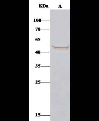 Immunoprecipitation: BLMH/Bleomycin Hydrolase Antibody [NBP2-98334] - Mouse BLMH/Bleomycin Hydrolase was immunoprecipitated using: Lane A: 0.5 mg 293T Whole Cell Lysate. 0.5 ul anti-Mouse BLMH/Bleomycin Hydrolase rabbit polyclonal antibody and 15 ul of 50 % Protein G agarose. Primary antibody: Anti-Mouse BLMH/Bleomycin Hydrolase rabbit polyclonal antibody, at 1:500 dilution. Secondary antibody: Clean-Bloto IP Detection Reagent (HRP) at 1:1000 dilution. Developed using the DAB staining technique. Performed under reducing conditions. Predicted band size: 53 kDa. Observed band size: 53 kDa