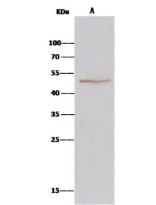 Immunoprecipitation: BLMH/Bleomycin Hydrolase Antibody [NBP2-99780] - BLMH/Bleomycin Hydrolase was immunoprecipitated using: Lane A: 0.5 mg HepG2 Whole Cell Lysate. 2 ul anti-BLMH/Bleomycin Hydrolase rabbit polyclonal antibody and 15 ul of 50 % Protein G agarose. Primary antibody: Anti-BLMH/Bleomycin Hydrolase rabbit polyclonal antibody, at 1:200 dilution. Secondary antibody: Clean-Bloto IP Detection Reagent (HRP) at 1:1000 dilution. Developed using the DAB staining technique. Performed under reducing conditions. Predicted band size: 53 kDa. Observed band size: 53 kDa