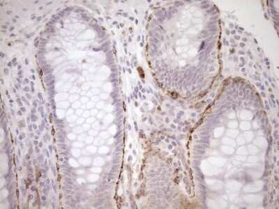 Immunohistochemistry: BLNK Antibody (4C9) [NBP2-46577] - Analysis of Human colon tissue. (Heat-induced epitope retrieval by 1mM EDTA in 10mM Tris buffer (pH8.5) at 120C for 3 min)