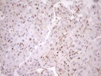 Immunohistochemistry: BLNK Antibody (4C9) [NBP2-46577] - Analysis of Human liver tissue. (Heat-induced epitope retrieval by 1mM EDTA in 10mM Tris buffer (pH8.5) at 120C for 3 min)