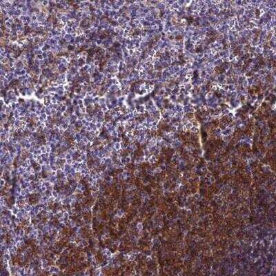 Immunohistochemistry: BLNK Antibody [NBP2-14356] - Staining of human spleen shows moderate cytoplasmic and nuclear positivity in cells in white pulp.