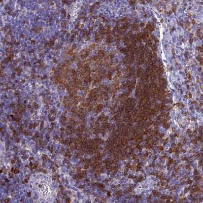 Immunohistochemistry-Paraffin: BLNK Antibody [NBP2-14355] - Staining of human lymph node shows high expression.