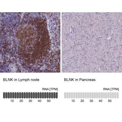 <b>Orthogonal Strategies Validation. </b>Immunohistochemistry-Paraffin: BLNK Antibody [NBP2-14355] - Staining in human lymph node and pancreas tissues using anti-BLNK antibody. Corresponding BLNK RNA-seq data are presented for the same tissues.