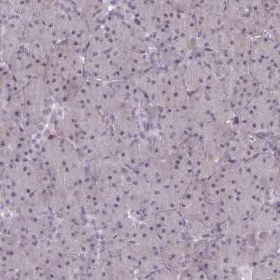 Immunohistochemistry-Paraffin: BLNK Antibody [NBP2-14356] - Staining of human pancreas shows low expression as expected.