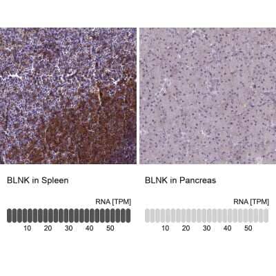 <b>Orthogonal Strategies Validation. </b>Immunohistochemistry-Paraffin: BLNK Antibody [NBP2-14356] - Staining in human spleen and pancreas tissues using anti-BLNK antibody. Corresponding BLNK RNA-seq data are presented for the same tissues.