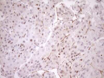 Immunohistochemistry: BLNK Antibody (OTI4C9) - Azide and BSA Free [NBP2-71855] - Analysis of Human liver tissue. (Heat-induced epitope retrieval by 1mM EDTA in 10mM Tris buffer (pH8.5) at 120C for 3 min)