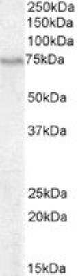 Western Blot: BLNK Antibody [NB100-804] - Staining of Daudi cell lysate (35 ug protein in RIPA buffer). Antibody at 0.3 ug/mL. Detected by chemiluminescence.