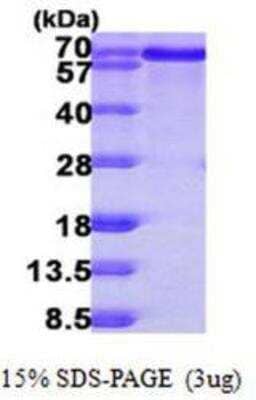 SDS-Page: BLNK Protein [NBP1-50993]