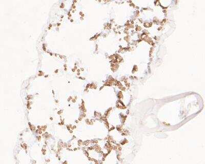 Immunohistochemistry-Paraffin: BLOC1S1 Antibody [NBP2-89162] - Analysis of paraffin-embedded A. thaliana tissue using anti-BLOS1 antibody. The section was pre-treated using heat mediated antigen retrieval with Tris-EDTA buffer (pH 8.0-8.4) for 20 minutes.The tissues were blocked in 5% BSA for 30 minutes at room temperature, washed with ddH2O and PBS, and then probed with the primary antibody for 30 minutes at room temperature. The detection was performed using an HRP conjugated compact polymer system. DAB was used as the chromogen. Tissues were counterstained with hematoxylin and mounted with DPX.