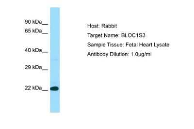 Western Blot: BLOS3 Antibody [NBP1-98303] - Antibody Dilution: 1.0ug/ml Sample Tissue: Human heart.