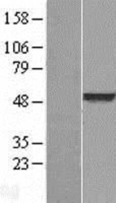 Western Blot: BLU Overexpression Lysate (Adult Normal) [NBL1-18048] Left-Empty vector transfected control cell lysate (HEK293 cell lysate); Right -Over-expression Lysate for BLU.