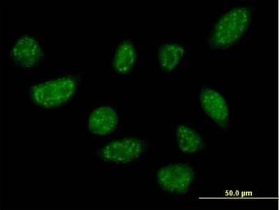 Immunocytochemistry/Immunofluorescence: BLZF1 Antibody [H00008548-B01P] - Analysis of purified antibody to BLZF1 on HeLa cell. (antibody concentration 10 ug/ml)