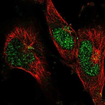 Immunocytochemistry/Immunofluorescence: BLZF1 Antibody [NBP2-57824] - Staining of human cell line U-251 MG shows localization to nucleus & the Golgi apparatus.