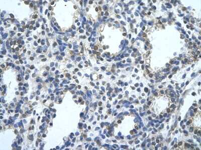 Immunohistochemistry-Paraffin: BLZF1 Antibody [NBP3-10474] - Immunohistochemical analysis of paraffin-embedded human alveolar cell tissue.