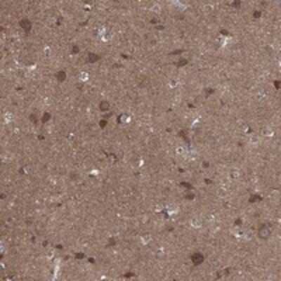 Immunohistochemistry-Paraffin: BMERB1 Antibody [NBP3-17471] - Staining of human cerebral cortex shows strong cytoplasmic positivity in neuronal cells and neuropil.
