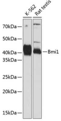 Western Blot: BMI-1 Antibody (6H9B0) [NBP3-15562] - Western blot analysis of extracts of various cell lines, using BMI-1 antibody (NBP3-15562) at 1:1000 dilution. Secondary antibody: HRP Goat Anti-Rabbit IgG (H+L) at 1:10000 dilution. Lysates/proteins: 25ug per lane. Blocking buffer: 3% nonfat dry milk in TBST. Detection: ECL Basic Kit. Exposure time: 60s.