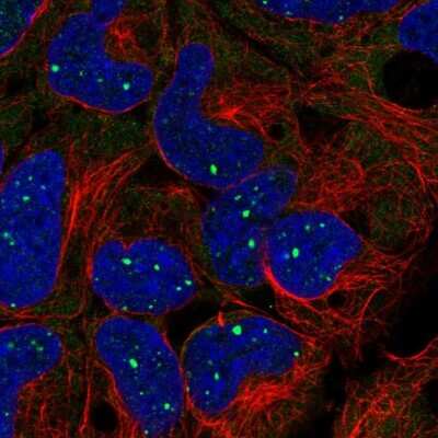 Immunocytochemistry/Immunofluorescence: BMI-1 Antibody [NBP2-57552] - Staining of human cell line HEK 293 shows localization to nuclear bodies.