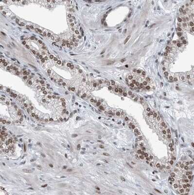 Immunohistochemistry-Paraffin: BMI-1 Antibody [NBP1-87321] - Staining of human prostate shows moderate nuclear positivity in glandular cells.