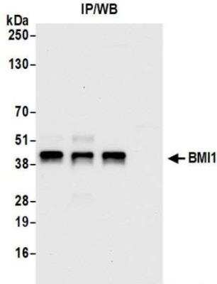 Immunoprecipitation: BMI-1 Antibody [NBP3-14704] - Whole cell lysate (1.0 mgper IP reaction; 20% of IP loaded) from HEK293T cellsprepared using NETN lysis buffer. Antibodies: Rabbit antiBMI1 recombinant monoclonal antibody used for IP at 6 ul/mg lysate. BMI1 wasalso immunoprecipitated by rabbit anti-BMI1 antibodies and For blottingimmunoprecipitated BMI1, was used at 1:1000.Chemiluminescence with an exposure time of 10 seconds.