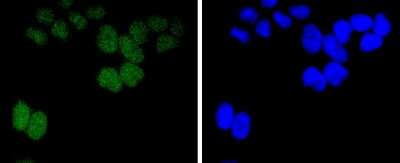 Immunocytochemistry/Immunofluorescence: BMI-1 Antibody (JJ093-3) [NBP2-67916] - Staining Bmi1 in Hela cells (green). The nuclear counter stain is DAPI (blue). Cells were fixed in paraformaldehyde, permeabilised with 0.25% Triton X100/PBS.