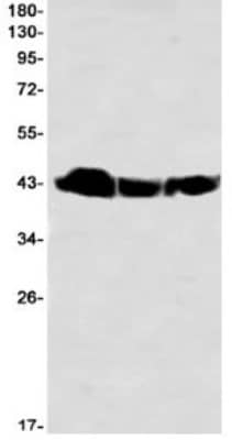 Western Blot: BMI-1 Antibody (S08-7A6) [NBP3-19839] - Western blot detection of BMI-1 in C6 (Lane 1), Rat Brain (Lane 2), Ramos (Lane 3)using NBP3-19839 (1:1000 diluted)