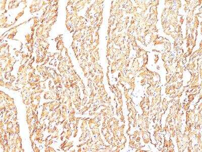 Immunohistochemistry-Paraffin: BMP-10 Antibody [NBP2-99411] - Staining of human BMP10 in human heart with rabbit polyclonal antibody at 1:1000 dilution.