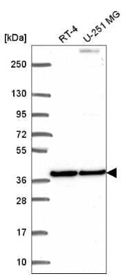 Western Blot: BMP-2 Antibody [NBP2-56251] - Analysis in human cell line RT-4 and human cell line U-251 MG.